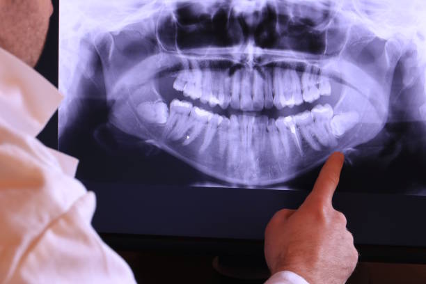Best Emergency Denture Repair in Freeland, WA